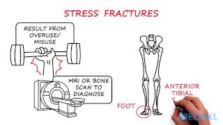 Orthopedics  Bone or Joint Injury By Shalini Ramasunder MD [upl. by Dupre501]