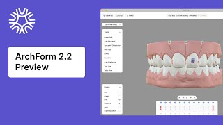 ArchForm 22 Preview [upl. by Nirrep]