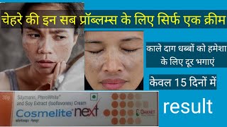 चेहरे के काले दाग धब्बों के लिए बेस्ट क्रीमcosmelite next cream review usesdosageside effects [upl. by Dearr]