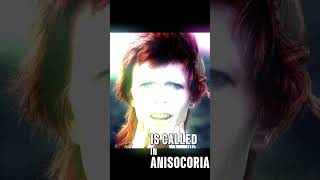 David Bowie’s Iconic Eye Look Was Caused by THIS musicianlife davidbowie funfacts [upl. by Ennovy262]