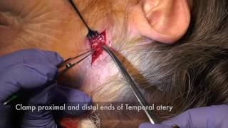 Temporal Artery Biopsy [upl. by Arualana109]