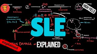 SYSTEMIC LUPUS ERYTHEMATOSUS Pathogenesis EULAR Guidlines Classification Treatment [upl. by Mokas]