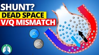 Shunt vs Dead Space vs VQ Mismatch  EXPLAINED [upl. by Amairam]