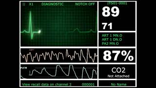 Hospital Monitor with FlatLine L HD [upl. by Tekcirk]