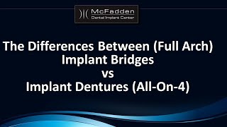 Implant Bridges vs Implant Dentures AllOn4 [upl. by Richlad]