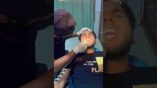 Teeth scaling and polishing krwai minivlog viralvlogs trendingshorts foryou [upl. by Ecirrehs319]