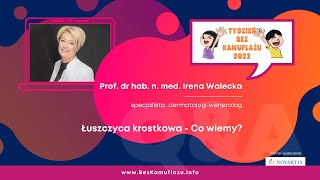 Łuszczyca krostkowa Prof Irena Walecka [upl. by Ainorev]