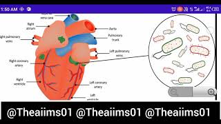 Endocarditis Cardiovascular diseasesdisorders [upl. by Araht]