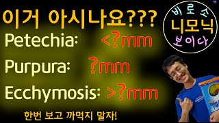 니모닉 Petechia purpura Ecchymosis [upl. by Erised]