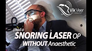 NightLase  Somnilase  Snoring Laser WITHOUT anaesthetic [upl. by Bik]