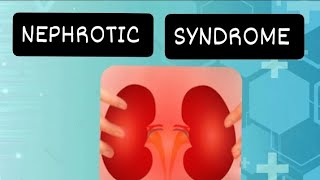 nephrotic  syndrome  medical  pediatrics [upl. by Llyrehc]