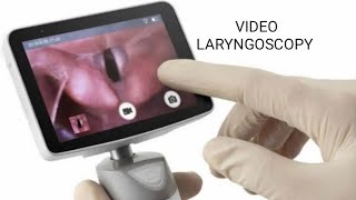 Video laryngoscopy [upl. by Demy]