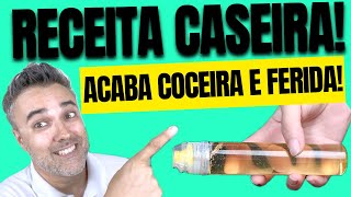 RECEITA CASEIRA acaba ✅COCEIRA ✅FERIDA ✅Dermatite [upl. by Franklyn]