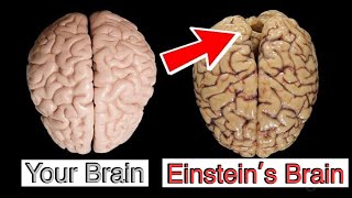 How Einsteins Brain was Different [upl. by Sigler]