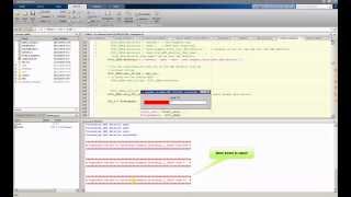 ECGkit  Automatic QRS detection [upl. by Borlow]