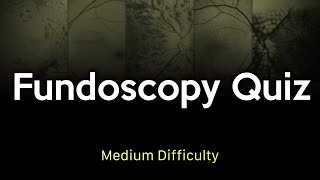 Fundoscopy Quiz Medium Difficulty [upl. by Erdnaxela]