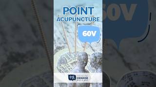 POINT D’ACUPUNCTURE  60V  Kun Lun acupuncture acupuncturepoints medecinechinoise [upl. by Cynthy]