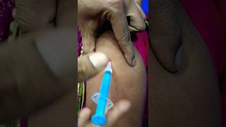 Titanus Intramuscular Injection 😱💉pharmacy doctor trendingshorts [upl. by Emmalee]