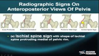 MRI Online Hip Imaging Part XIII [upl. by Bigg]