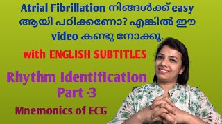 How to identity Atrial Fibrillation Easy way in malayalam for nursesRhythm Identification Part3 [upl. by Egap]