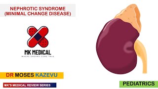 Nephrotic Syndrome Minimal Change Disease [upl. by Fredric]