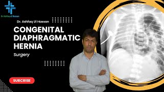 Congenital Diaphragmatic Hernia High Yield Topic Pediatrics [upl. by Anthony169]