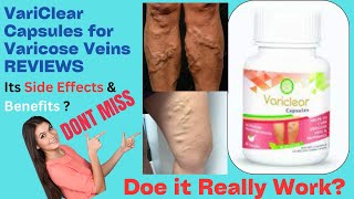 Variclear Capsules for Varicose Veins Reviews Does it Really Work Side Effects [upl. by Christos]