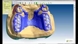 Logiciel CAO DIGISTELL pour la création de châssis squeletté pour prothésistes dentaires Part 2 [upl. by Larine]