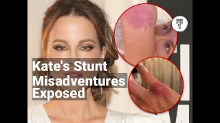 Kate Beckinsale Reveals Severe Stunt Injuries [upl. by Page984]