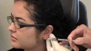 Hyaluronic Acid Earlobe Injection  Dr Steven Dayan [upl. by Siesser]