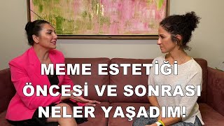 Meme Estetiği Olmadan Mutlaka İzle  Meme Estetiği Öncesi Sonrası Neler Yaşadım  Dr Leyla Arvas [upl. by Ahseka]