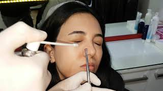 Uyuşturarak Burun  Nose  Piercing Deldirme [upl. by Wendell]