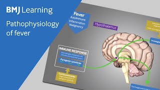 Pathophysiology of fever explained [upl. by Viki544]