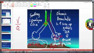 Oxyhemoglobin dissociation curve and clinical importance [upl. by Ellga]