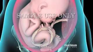 Breech Birth Position  3D Rotation [upl. by Phylis]