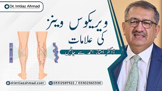 Causes of Varicose Veins  Dr Imtiaz Ahmad [upl. by Auhsej506]