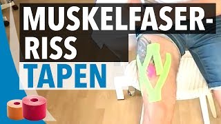 Muskelfaserriss Tapen Anleitung  Kinesiologie Tape Anleitung für Muskelfaserriss [upl. by Hoebart]