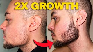 Minoxidil Beard Growth  How To Double Your Minoxidil Beard Growth Results [upl. by Mott]