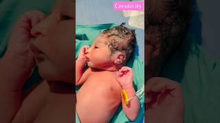 Just Born nicu medical viralvideo [upl. by Esilec]