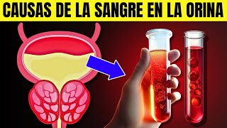 7 Causas de Sangre En La Orina  Hematuria [upl. by Adnolohs]