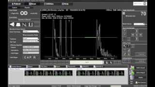 Performing IOL Calculations with the Ellex Eye Cubed [upl. by Micheil]