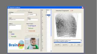 DMIT Fingerprint Analysis  Multiple Intelligences Test [upl. by Tizes236]