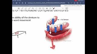 Anatomy of edentulous maxilla part one [upl. by Zia]