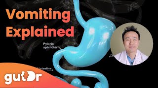 What Happens During Vomiting  The GutDr Explains 3D Gut Animation [upl. by Philcox]