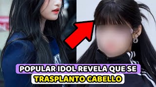 POPULAR IDOL REVELA ABIERTAMENTE QUE SE TRASPLANTO CABELLO [upl. by Harlin465]