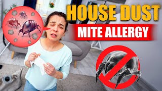 How to Fix Dust and Dust Mite Allergies  House Dust Allergy  Dr Richa Thukral  Apollo Noida [upl. by Lawton186]