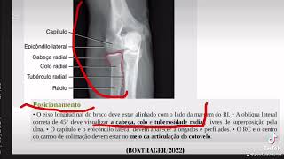OBLÍQUA EXTERNO DO COTOVELO [upl. by Boris]