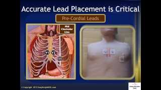 EKG Lead Placement [upl. by Yarahs]