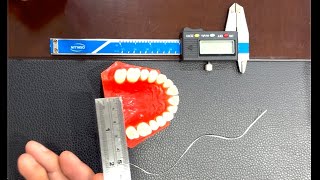 Inter molar distance or dental arch width measuring at home for patients [upl. by Llewon]