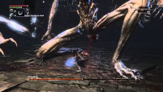 Bloodborne  HOW TO Kill Amygdala Super EasyDefiled Chalice [upl. by Eanat]